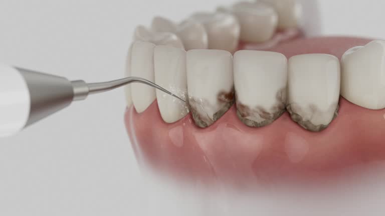 Reliable Wisdom Tooth Removal contractor in Belmont County County, OH by Dentist Open Now